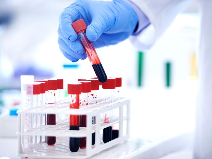 pathology service in lucknow